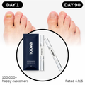 Antifungal Nail Pen (FREE Today)