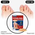 Antifungal Nail Patches (FREE Today)